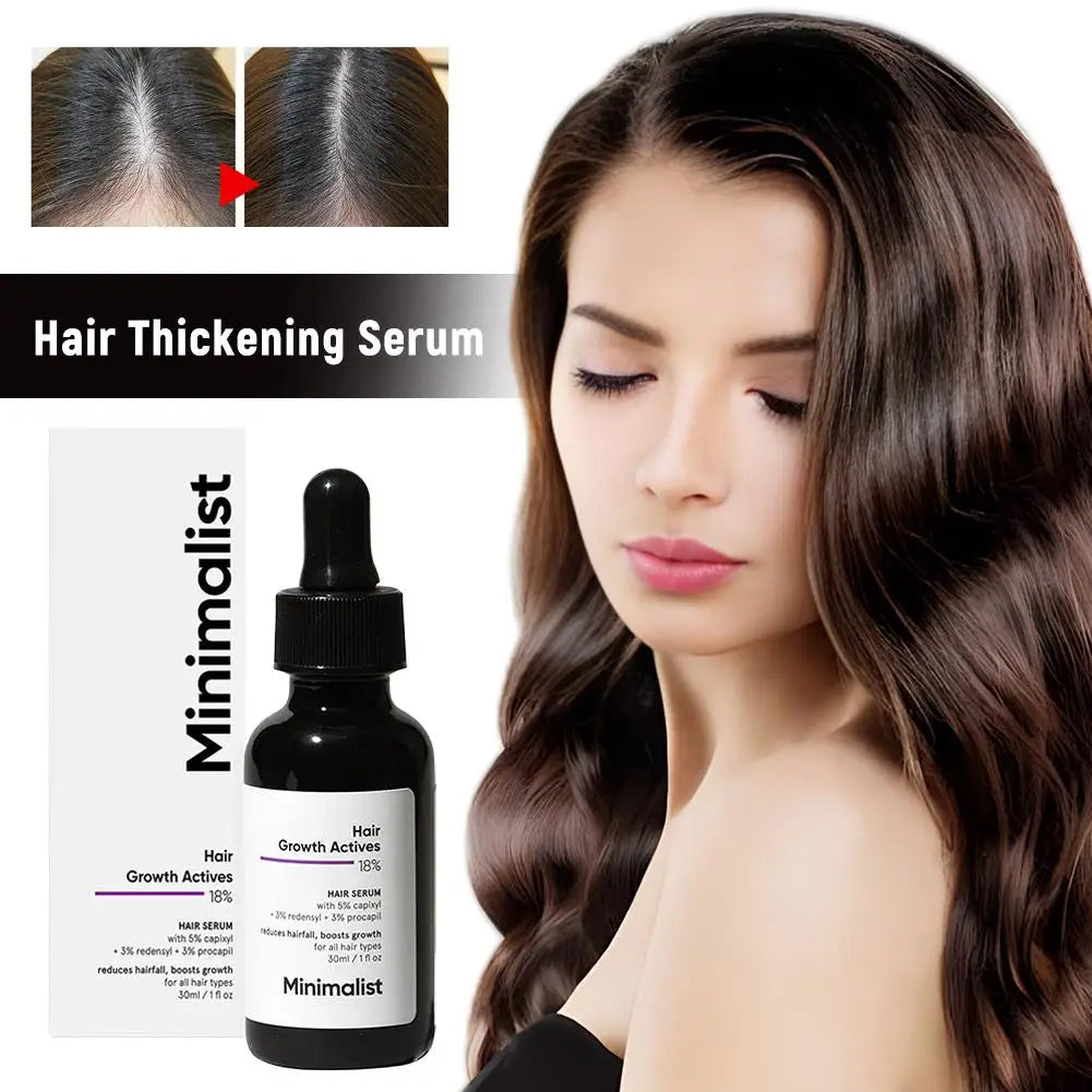 30ml Anti-Hair Loss Serum – Strengthen & Nourish Hair