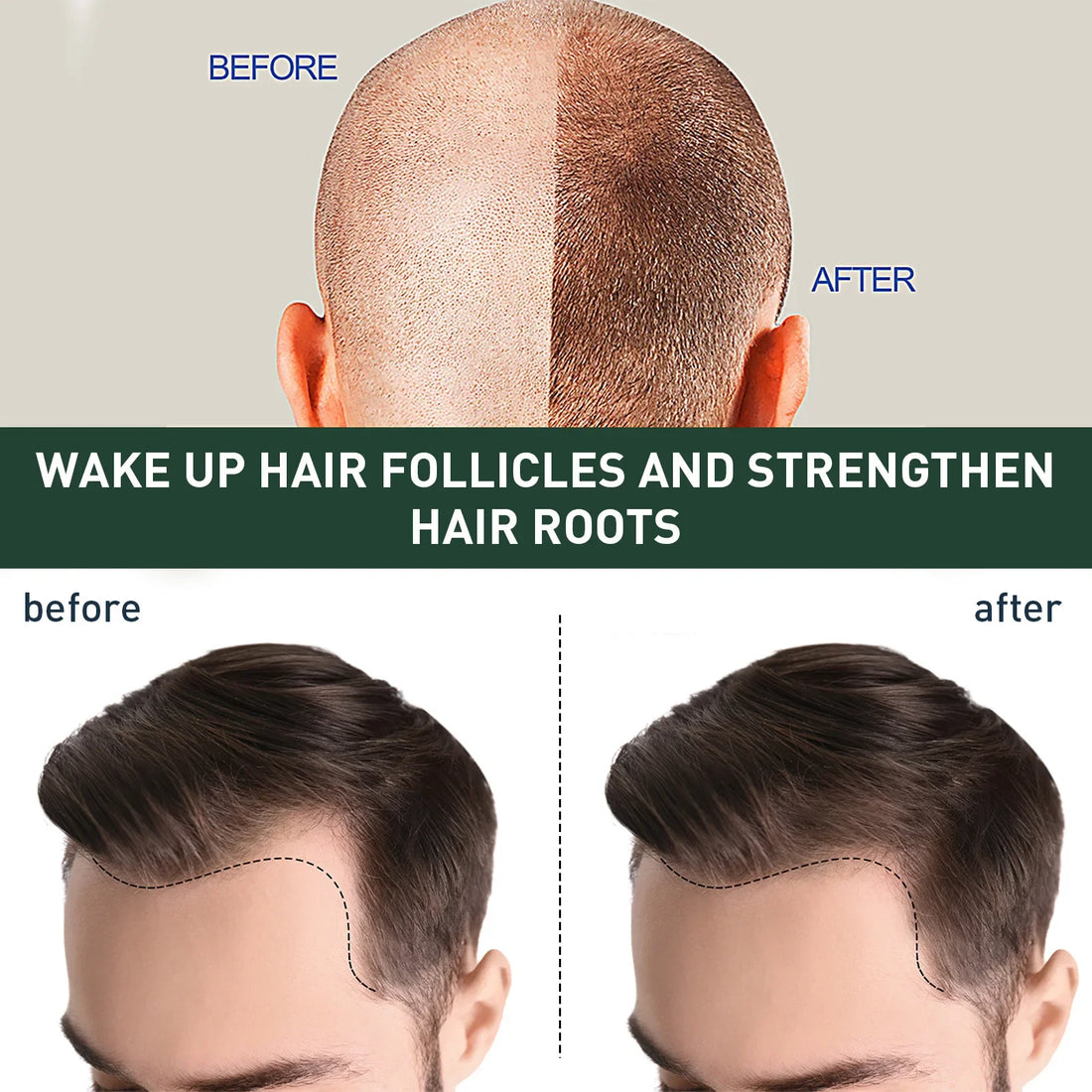 Hair Regrowth & Beard Thickening Serum